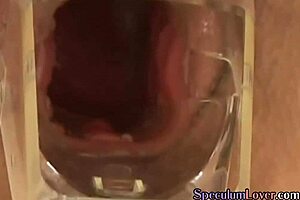 Speculum Babe Stretches Pussy with Baseball Bat Fucking