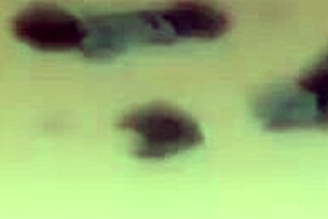 Black cat cap 1 episode 😺