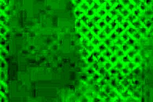 He Fucked Me Hard By His Fist And Big Hard Cock With Anal Creampie At The End Like It Sooo Much