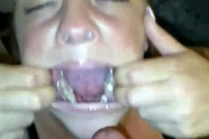 Nut Shot In Resaboo Mouth