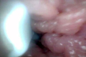 check out the penis close-up with endoscope