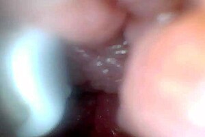 check out the penis close-up with endoscope