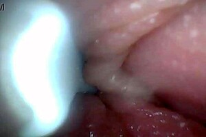 check out the penis close-up with endoscope