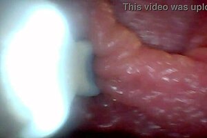 check out the penis close-up with endoscope