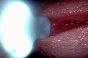 Endoscope Camera Captures Male Ejaculation Moment in Outdoor Creampie Scene