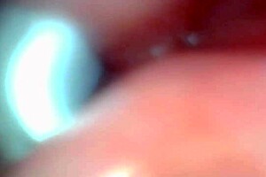 Endoscope Camera Captures Male Ejaculation Moment in Outdoor Creampie Scene