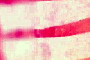 i got clitoral suction massage leading to squirting orgasm