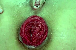 Destroyed anal juicy prolapse asshole close up play