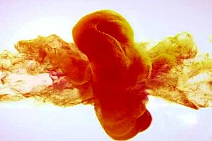 Wet pants, hot pants, let's get them off